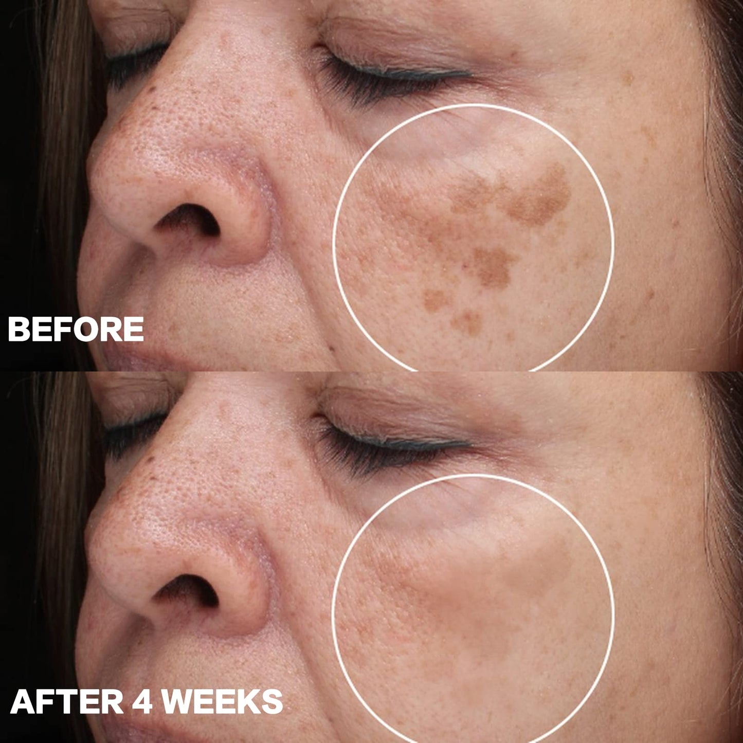 Hanjani™ Whitening Spot Serum