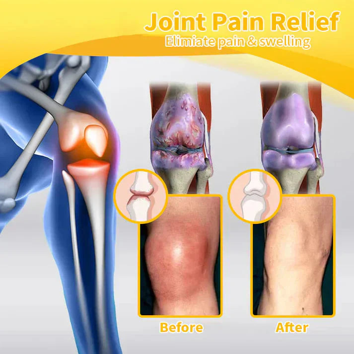🎁✅Official Store BUY 2 GET 1 FREE: flysmus™ Lidocaine Scar-Free Pain Relief Healing Liquid👨⚕️USA Osteopathic Medical Association (AAOS)Approved(Reducing joint swelling, pain, stiffness, redness, warmth, soreness and joint fatigue )