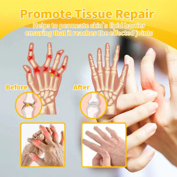 🎁✅Official Store BUY 2 GET 1 FREE: flysmus™ Lidocaine Scar-Free Pain Relief Healing Liquid👨⚕️USA Osteopathic Medical Association (AAOS)Approved(Reducing joint swelling, pain, stiffness, redness, warmth, soreness and joint fatigue )