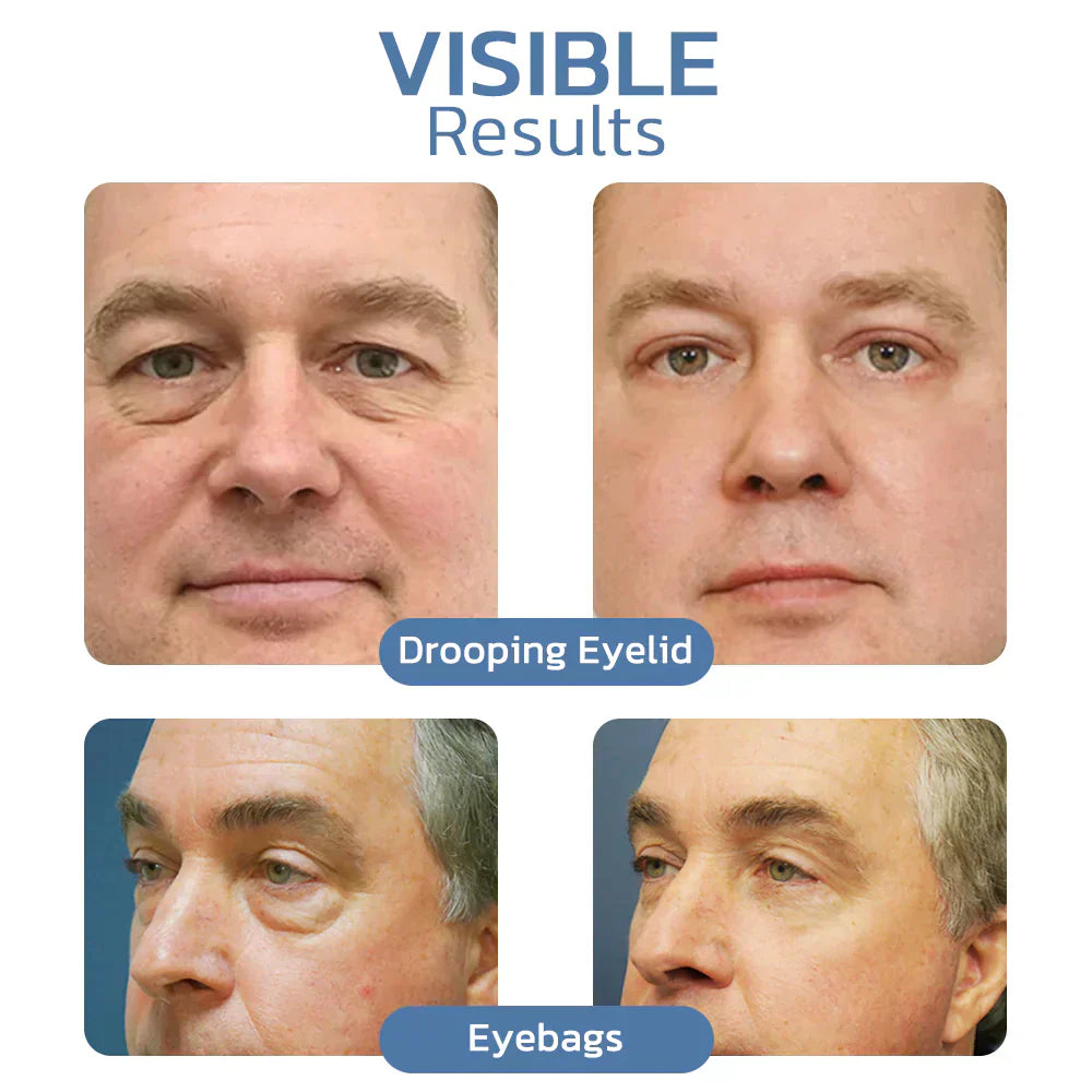 (š„Last Day Sale-80% OFF) LOVILDS⢠Awaken Peptide Lifting Eye Gel