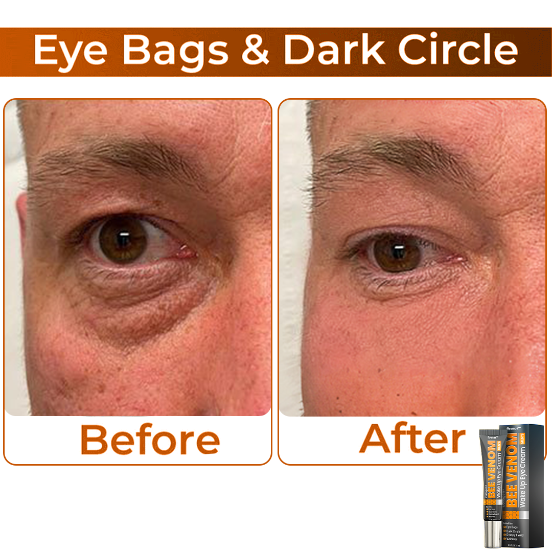 🎩 flysmus™ Collagen+ Bee Venom Wake Up Eye Cream for MEN 🇺🇸 Dermatologist Recommended