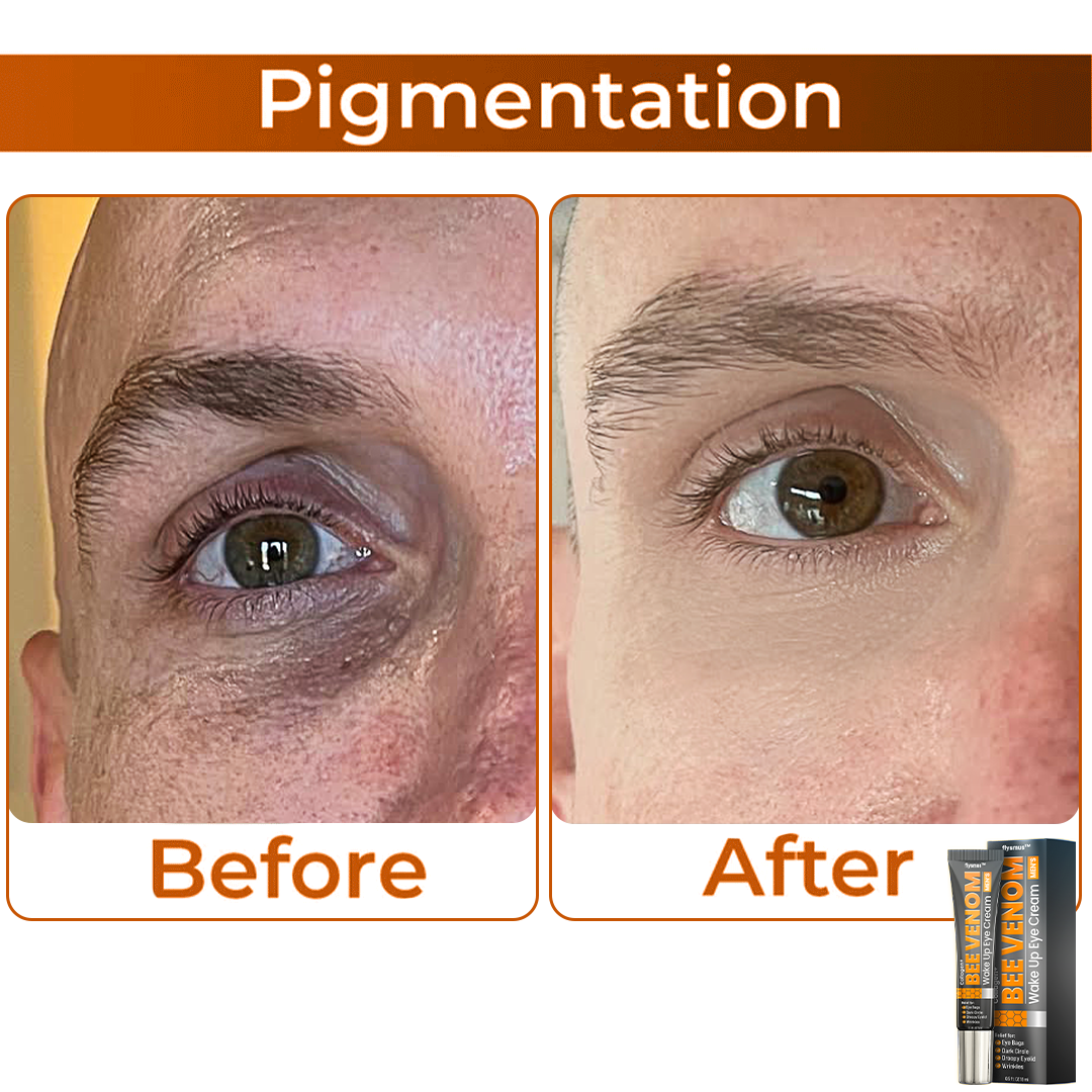 🎩 flysmus™ Collagen+ Bee Venom Wake Up Eye Cream for MEN 🇺🇸 Dermatologist Recommended