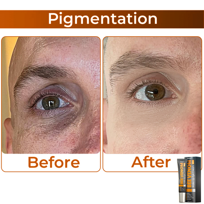 🎩 flysmus™ Collagen+ Bee Venom Wake Up Eye Cream for MEN 🇺🇸 Dermatologist Recommended