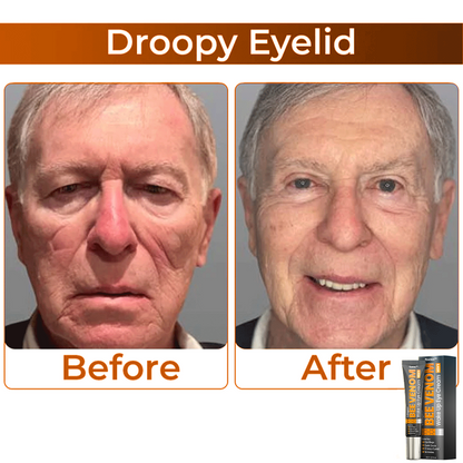 🎩 flysmus™ Collagen+ Bee Venom Wake Up Eye Cream for MEN 🇺🇸 Dermatologist Recommended