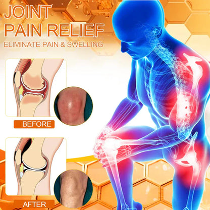 ✅ OFFICIAL STORE: NEGUSY™ Bee Venom Pain Relief Bone Healing Cream 👨‍⚕️ American Academy of Orthopaedic Surgery (AAOS) certified (Reduces joint swelling, pain, stiffness, redness, warmth, soreness and joint fatigue).