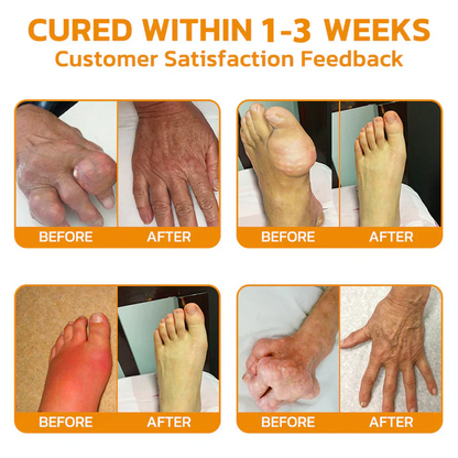 ✅ OFFICIAL STORE: NEGUSY™ Bee Venom Pain Relief Bone Healing Cream 👨‍⚕️ American Academy of Orthopaedic Surgery (AAOS) certified (Reduces joint swelling, pain, stiffness, redness, warmth, soreness and joint fatigue).